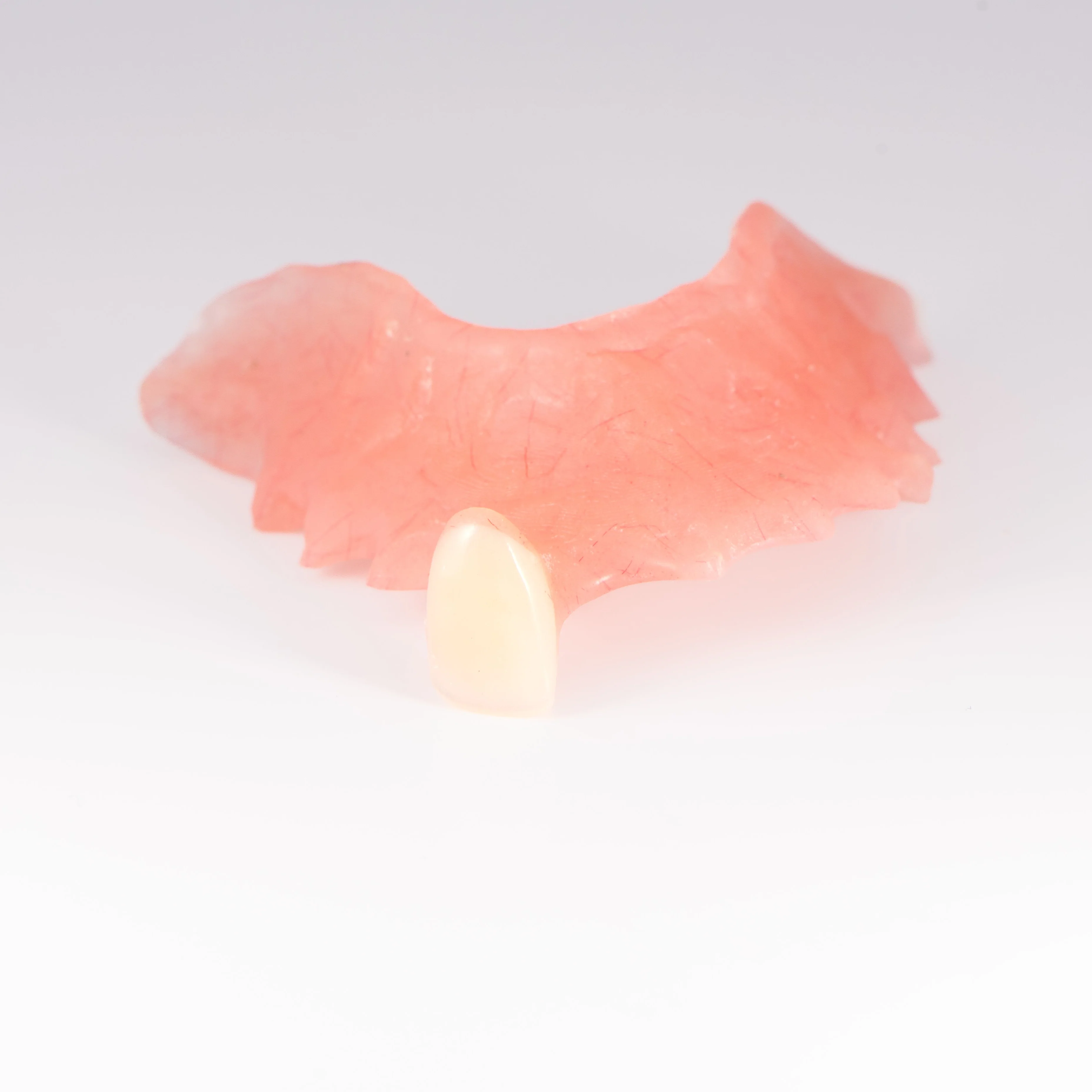 Acrylic Partial Flipper Denture - Image 6