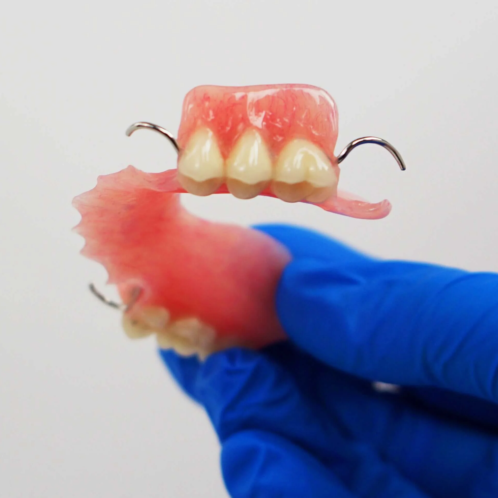 Acrylic Partial Flipper Denture - Image 8