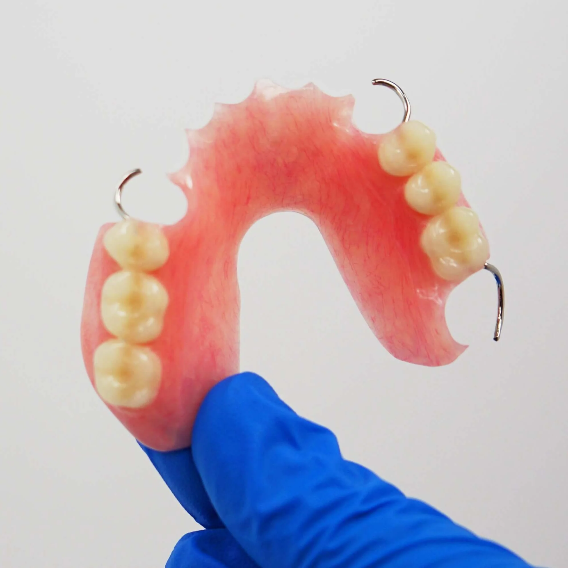 Acrylic Partial Flipper Denture - Image 9