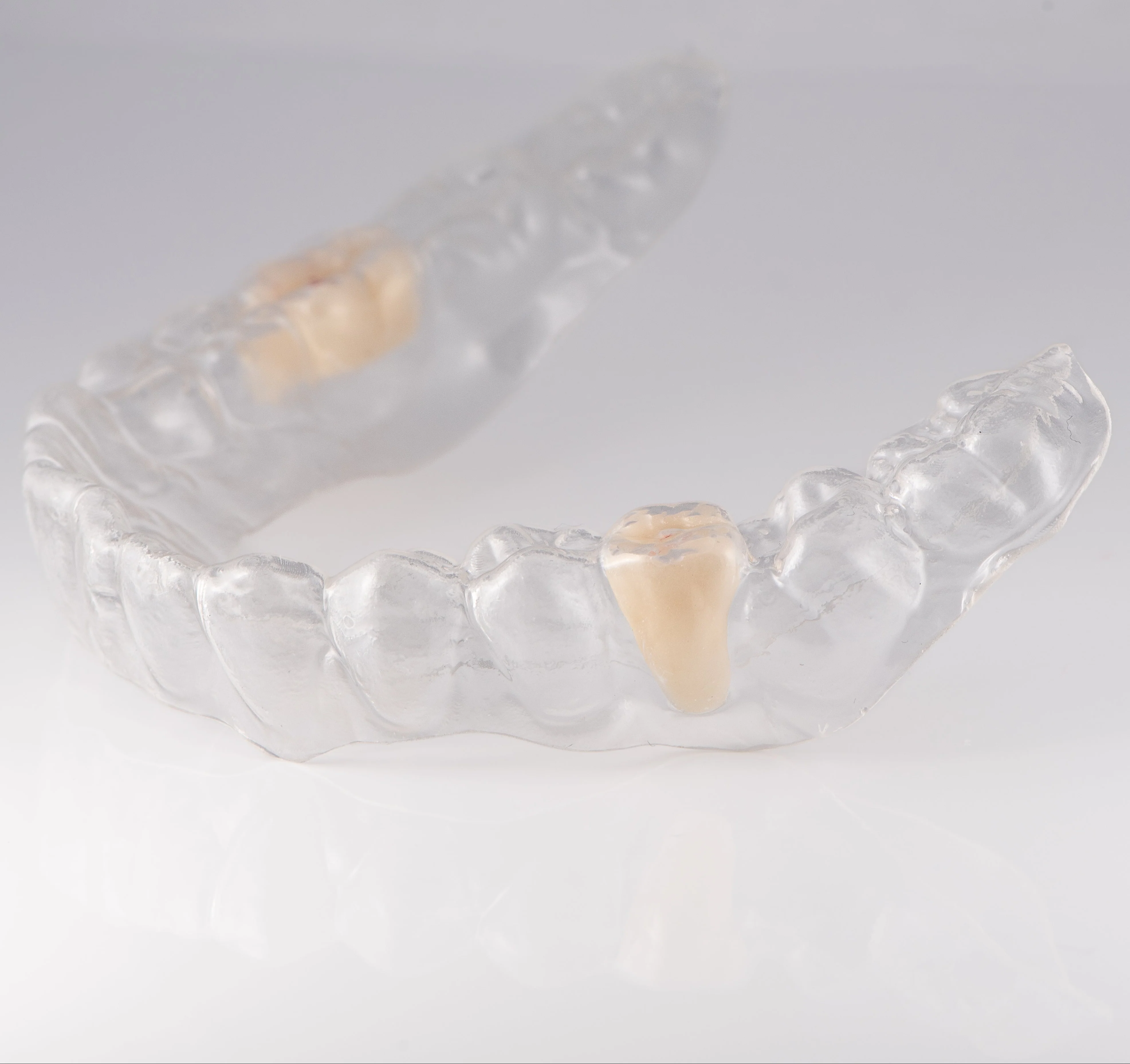 Essix Partial Denture Retainer - Image 3