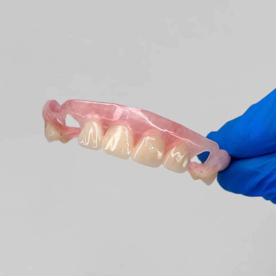 Flexible Partial Denture - Image 13