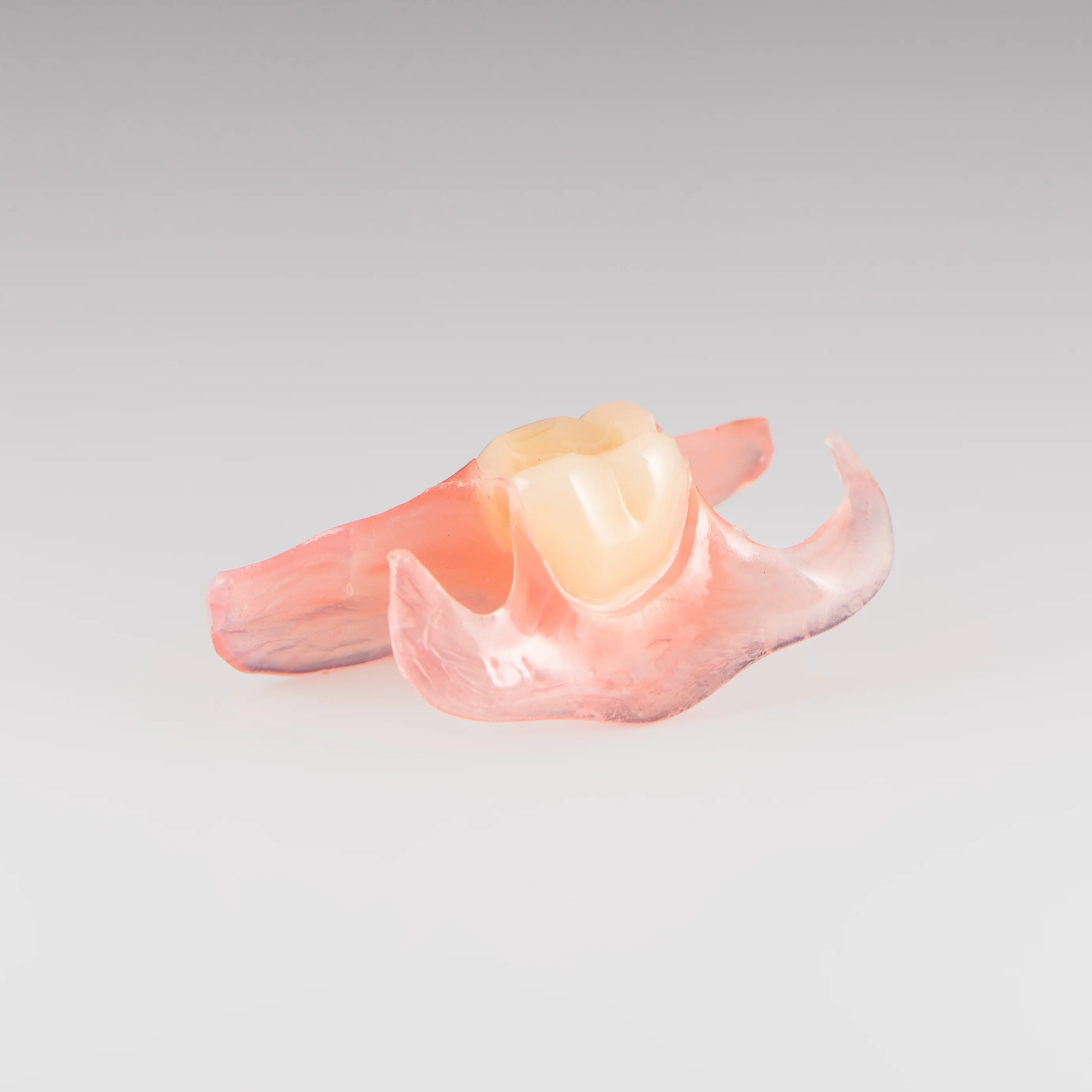 Unilateral Partial Denture - Image 5