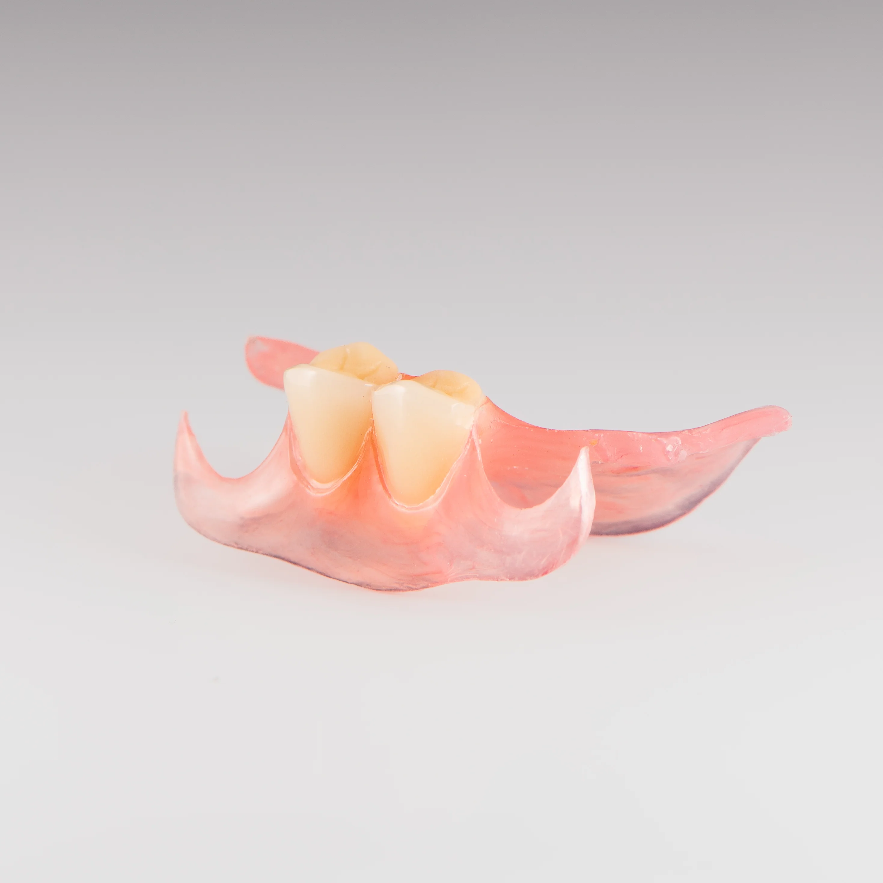 Unilateral Partial Denture - Image 7