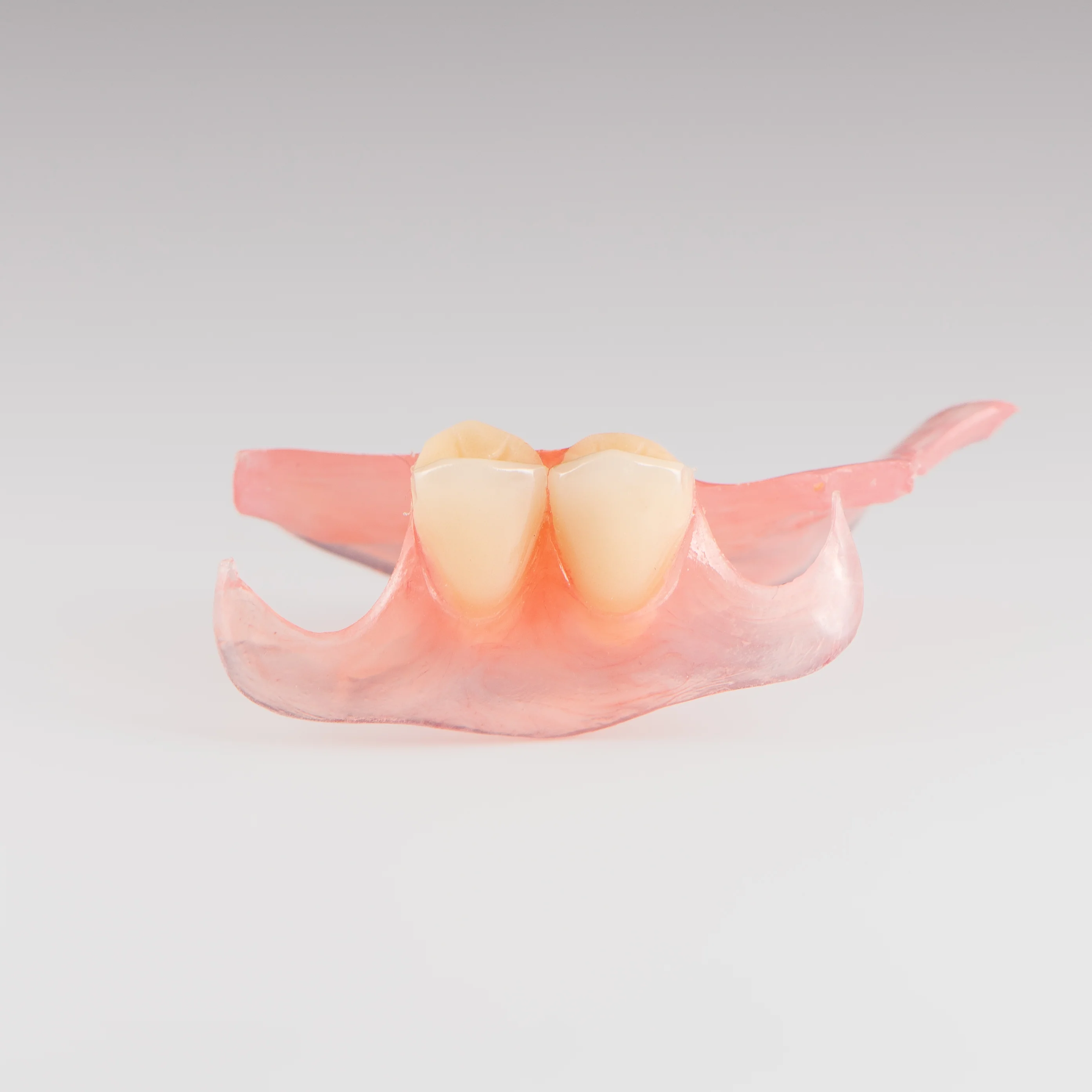 Unilateral Partial Denture - Image 8